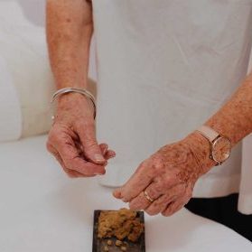 Acupuncture Treatments Sydney